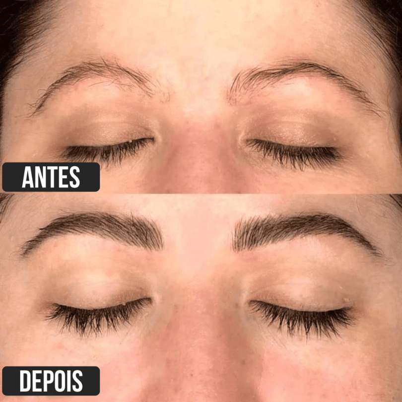 Resultado Mega Cílios